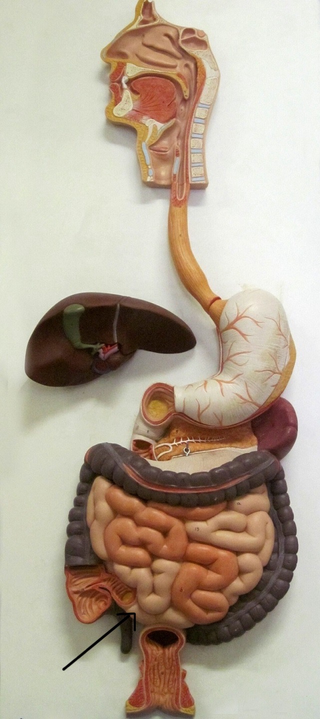 term image