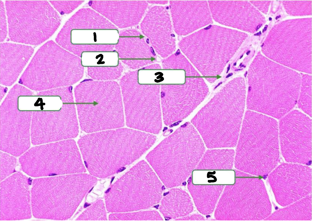<p>What is structure #1?</p>