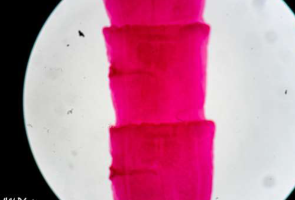 <p>Phylum &amp; name?</p>