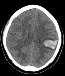 <p>Con la siguiente imagen, cual seria su diagnostico probable</p>