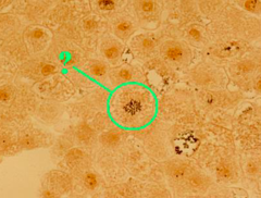 <p>identify the indicated phase of mitosis</p>