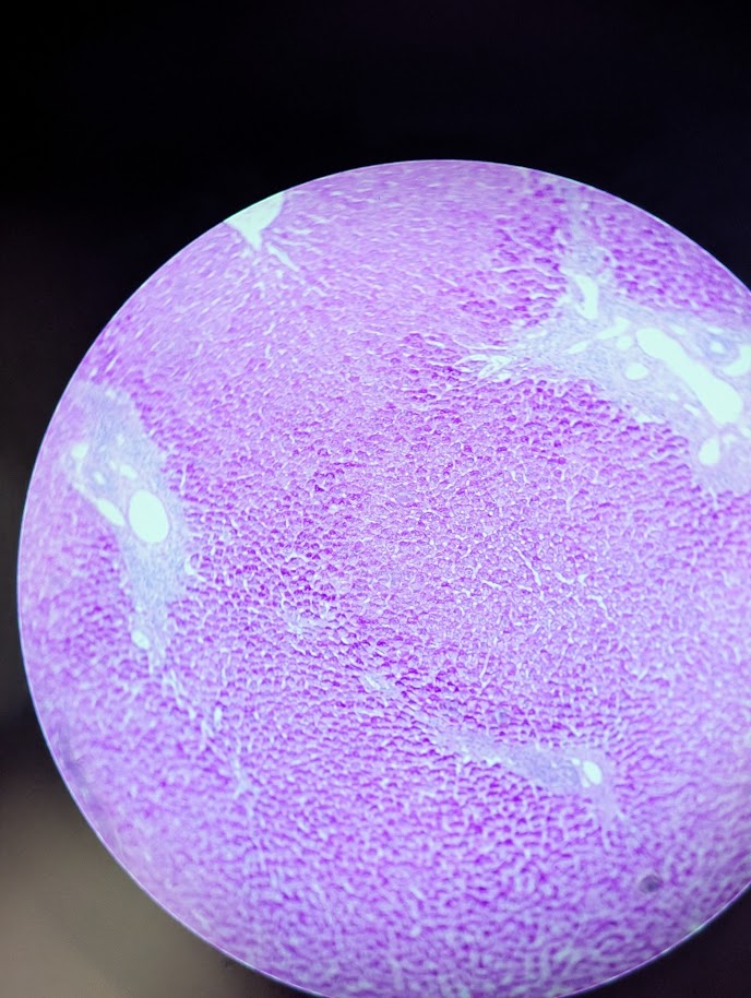 <p>Where in the body is this</p>