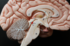 <p>a narrow tube interconnecting the third and fourth ventricles of the brain, located in the center of the mesencephalon</p>