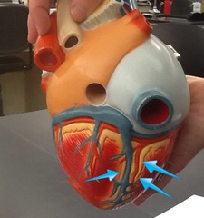 <p>Groove of fat on the back of the heart</p><p>name this GROOVE</p>