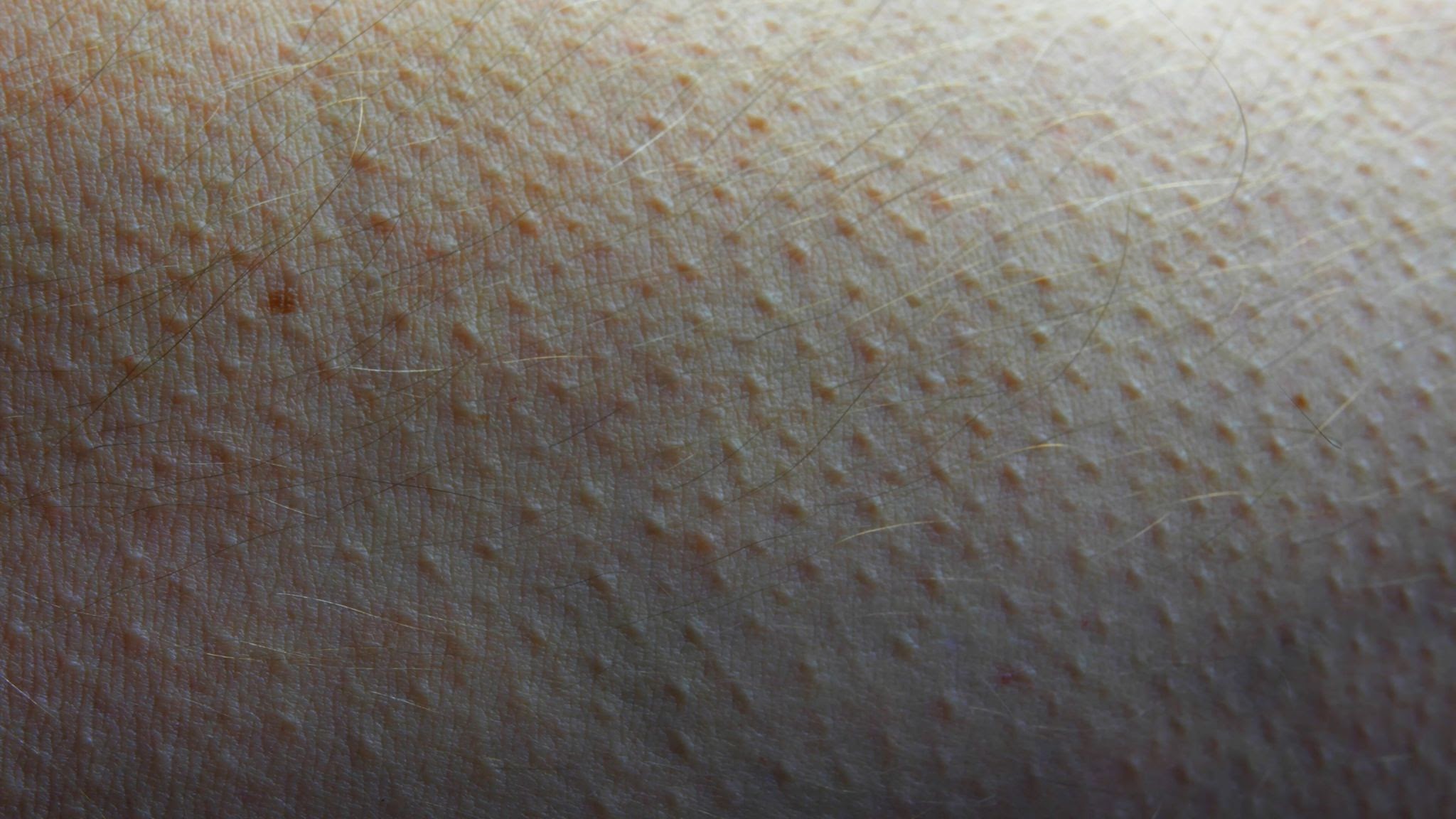To make someone feel so scared or nervous that they get goosebumps.