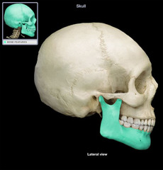<p>Which skull bone is shown?</p>