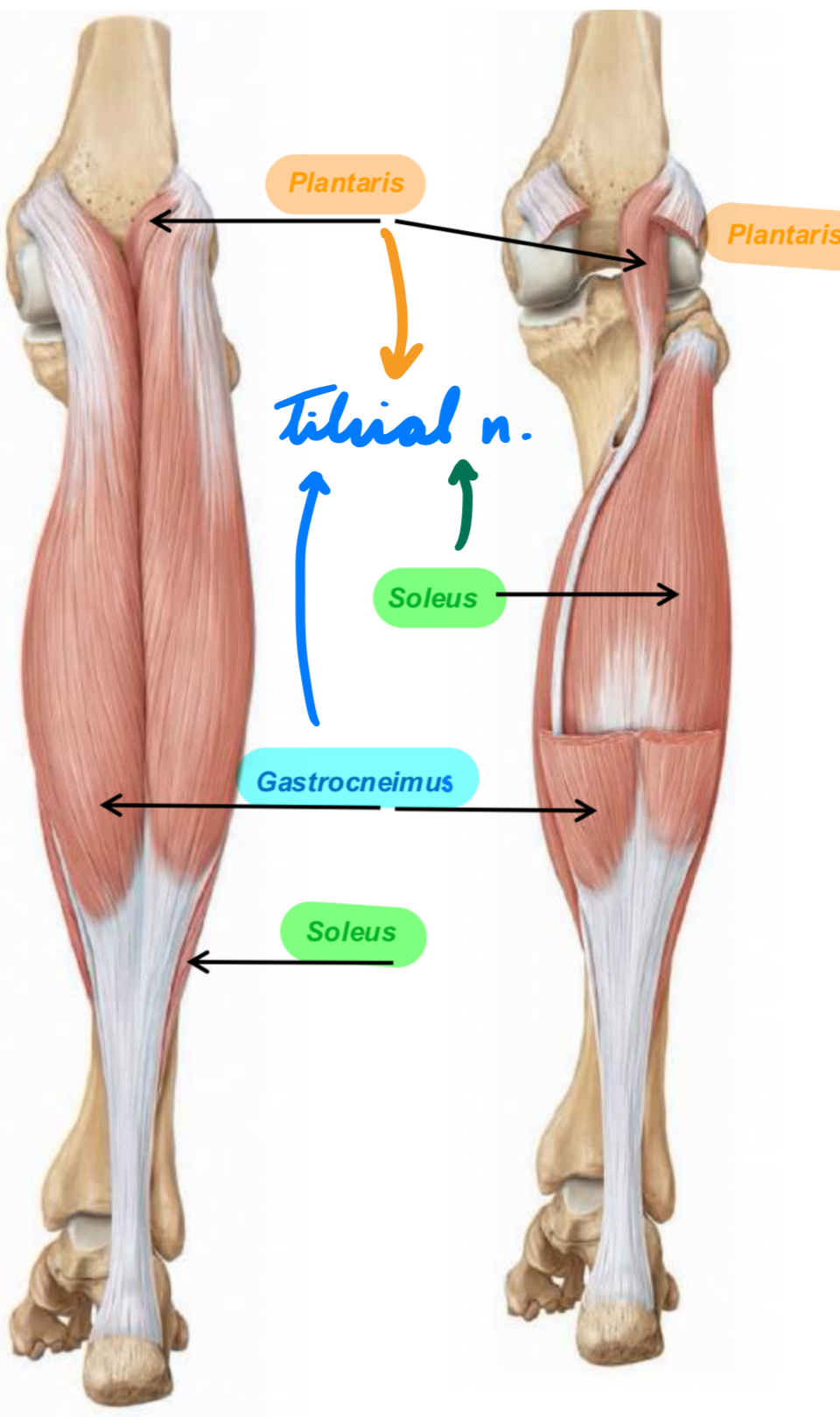 <p>Tendons fuse = Tendo calcaneus (Achilles tendon)</p><p>Gastrocnemius</p><ul><li><p>Lateral + medial head</p></li><li><p>Action:</p><ul><li><p>Ankle plantarflexion</p></li><li><p>Knee flexion</p></li></ul></li></ul><p>Soleus</p><ul><li><p>Action: Ankle plantarflexion</p></li></ul><p>Innervation: Tibial n.</p>