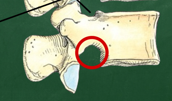 <p>What notch contributes to formation of the intervertebral foramen from below?</p>