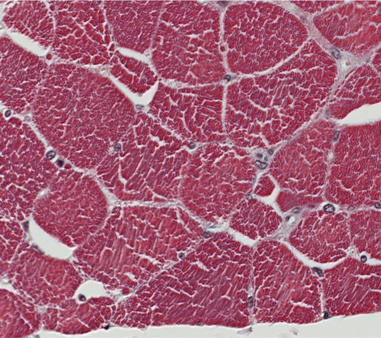 <p><span style="font-family: "Calibri Light";">Which internal structures create the “stippling” visible inside these transversely sectioned muscle cells? <br><br>Hint: Filament << Fibril << Fiber</span></p>