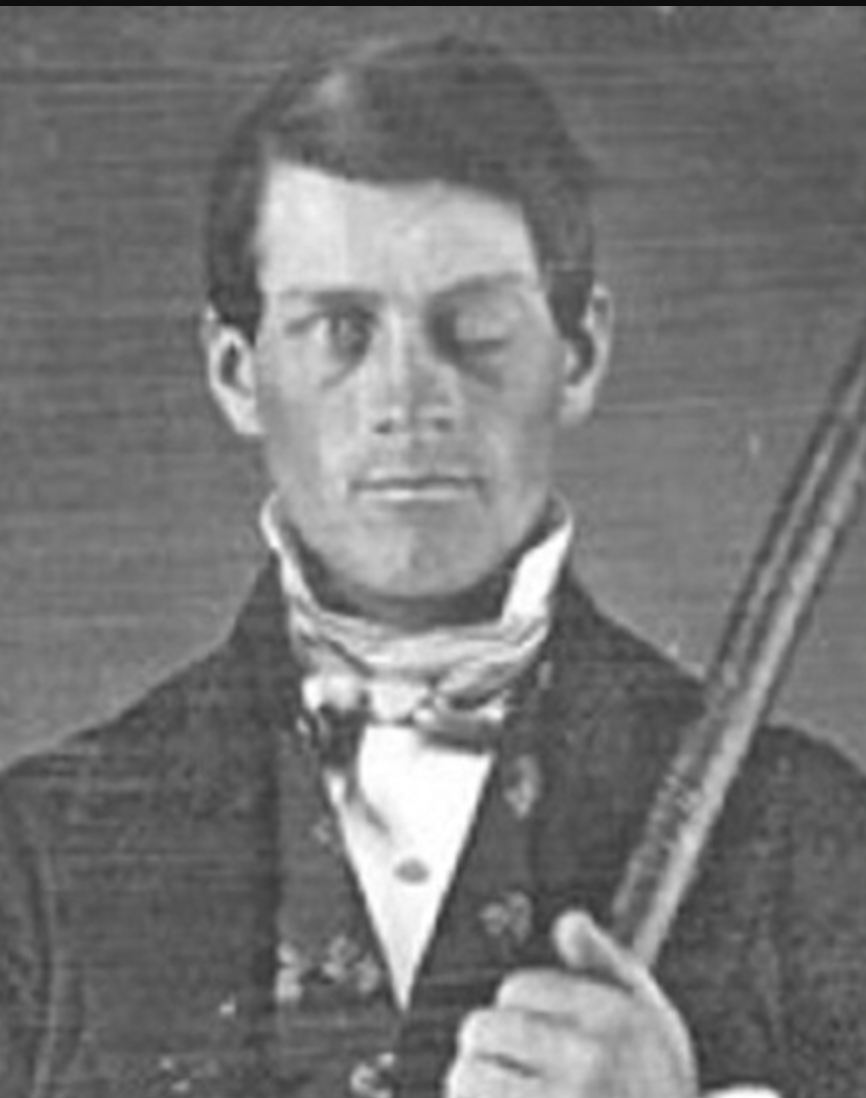 <ul><li><p><strong>true</strong></p><ul><li><p>Phineas Gage, 1848: survived a rod up through his left cheek + out top of his skull, leaving frontal lobes damaged</p><ul><li><p>quick recovery, HOWEVER, frontal lobes + brain regions that control emotion + decision making connections were damaged</p></li><li><p>drastic personality change, most mental abilities + memories intact</p></li></ul></li><li><p>frontal lobes help w/ moral compass</p></li></ul></li></ul><p></p>