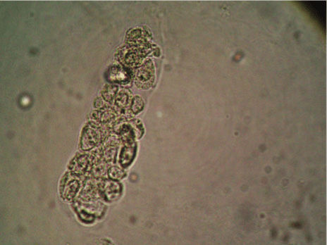 <p>Generally renal tubular epis with in the protein matrix.</p>