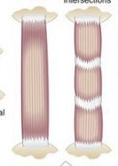<p>What kind of muscle shape is this? Describe it.</p>