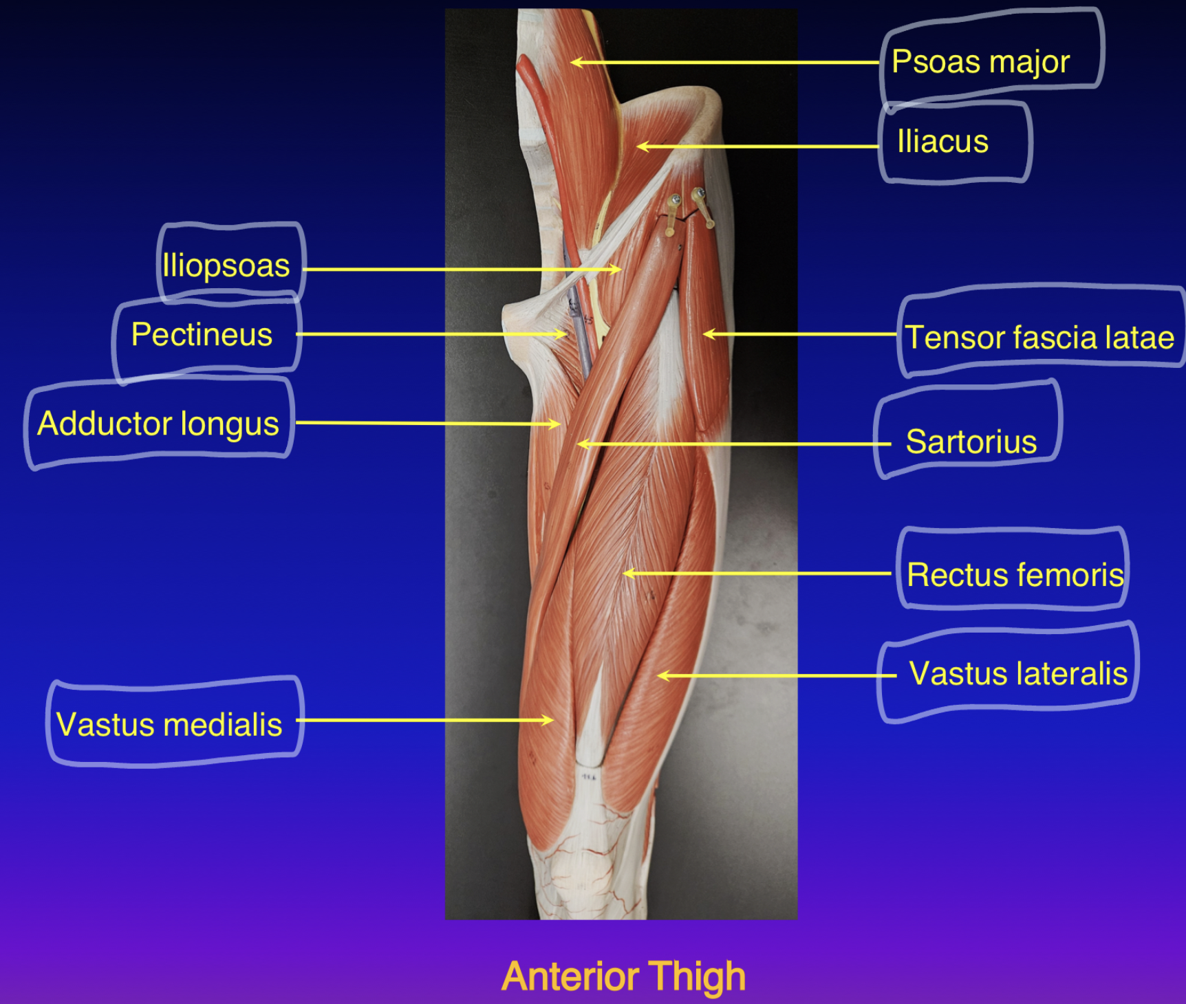 <ol><li><p>origin: anterior superior iliac spine</p></li><li><p>insertion: medial, proximal tibia</p></li><li><p>action: <u><mark data-color="#ffd5e9" style="background-color: rgb(255, 213, 233); color: inherit;">Flex leg</mark></u><mark data-color="#ffd5e9" style="background-color: rgb(255, 213, 233); color: inherit;">, laterally rotate thigh</mark></p></li><li><p>innervation: femoral nerve</p></li></ol><p>Sartorius becomes a tendon, once past the knee</p>