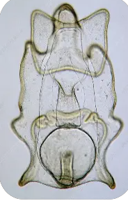 <p>free-swimming larval stage in most starfish (Asteroidea), typically transforms into brachiolaria larva which has additional arms for adhering to things</p>