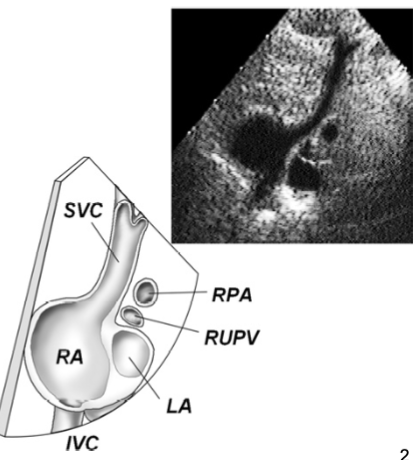 <p>Showcases normal SVC presentation</p>