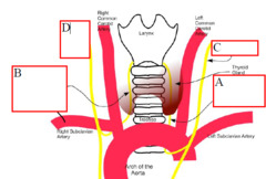 <p>What is A on diagram</p>