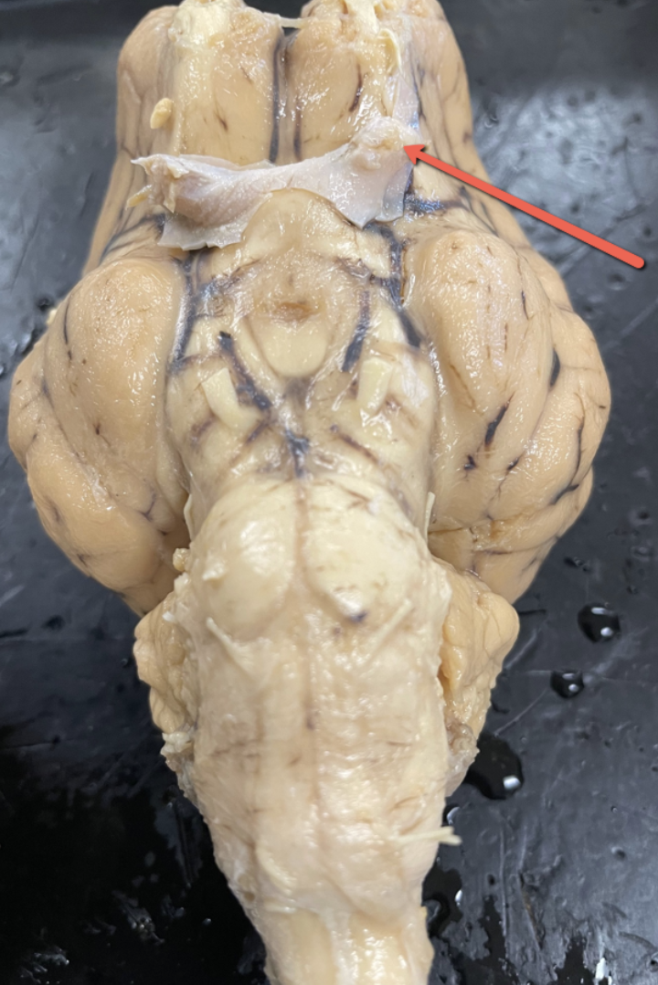 <p><span>Identify the cranial nerve indicated by the pointer.</span></p>