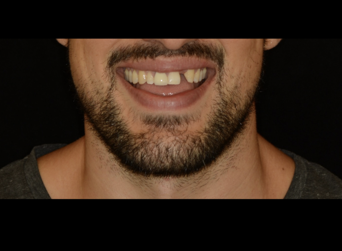 <p>approaches for tx for this pt </p>