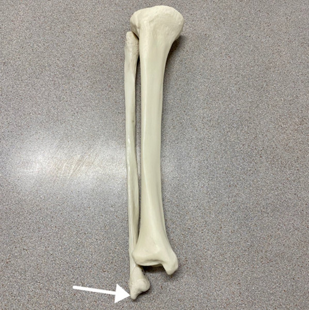 <p>What is this?</p>