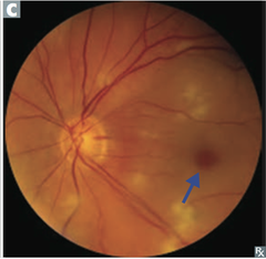 <p>macula</p>