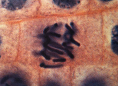 <p>What phase is shown here?</p>