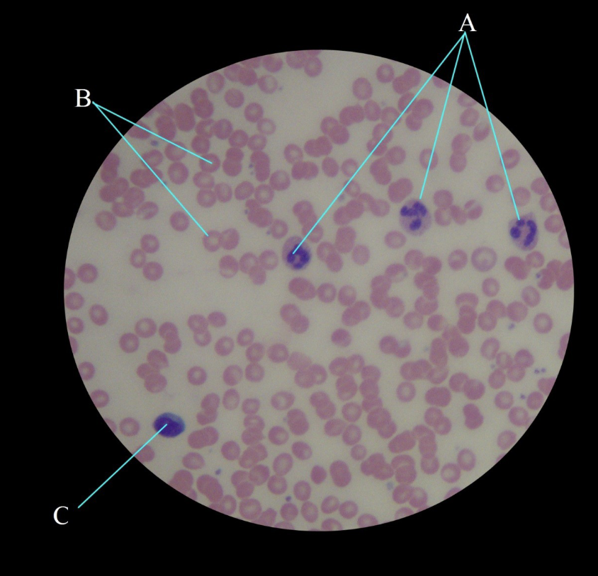 <p>Where is it, what is A, what is b, what is c</p>