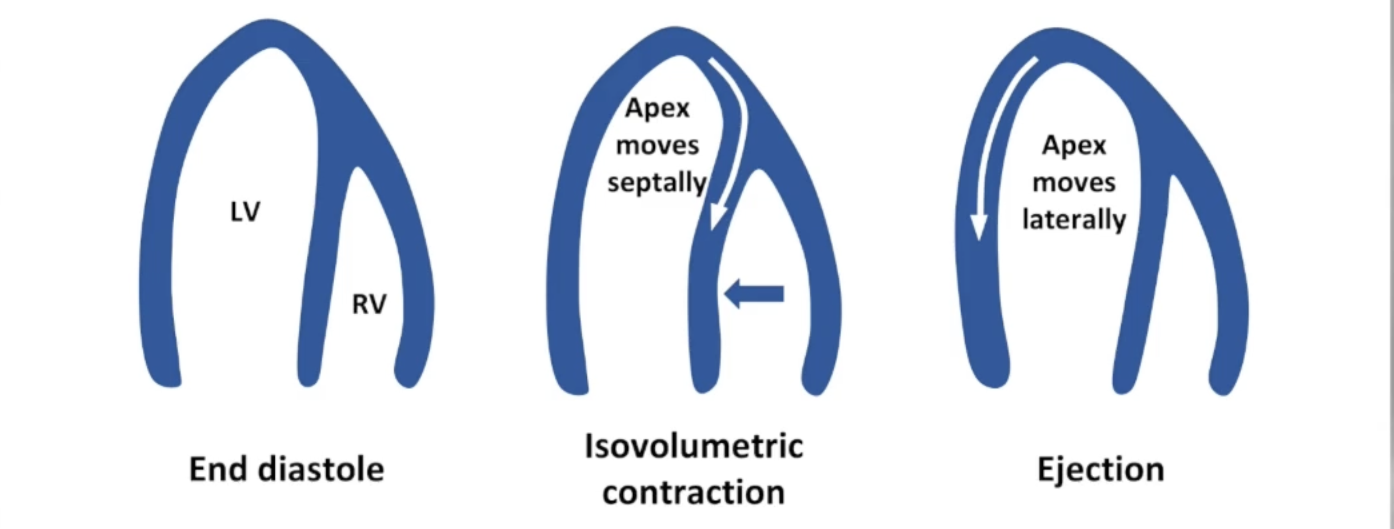 <p>End diastole</p><p>Isovolumetric contraction</p><p>Ejection</p>
