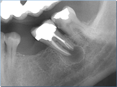 <p>Describe the characteristics of this lesion: (5)</p>