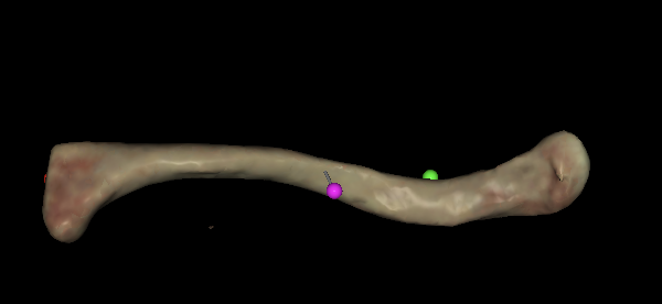 <p>Is this superior or inferior on <strong>left</strong> clavicle?</p>
