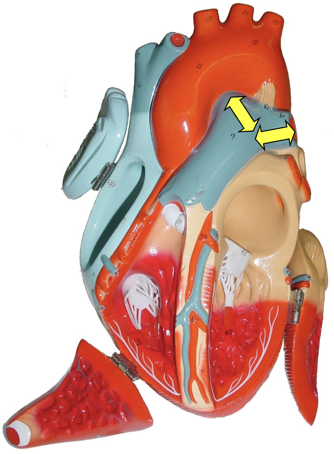 <p>what part of the heart muscle is shown?</p>