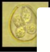 <ul><li><p>Eimeria maxima</p></li></ul><p></p>