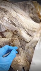 <p>Name the muscle</p>