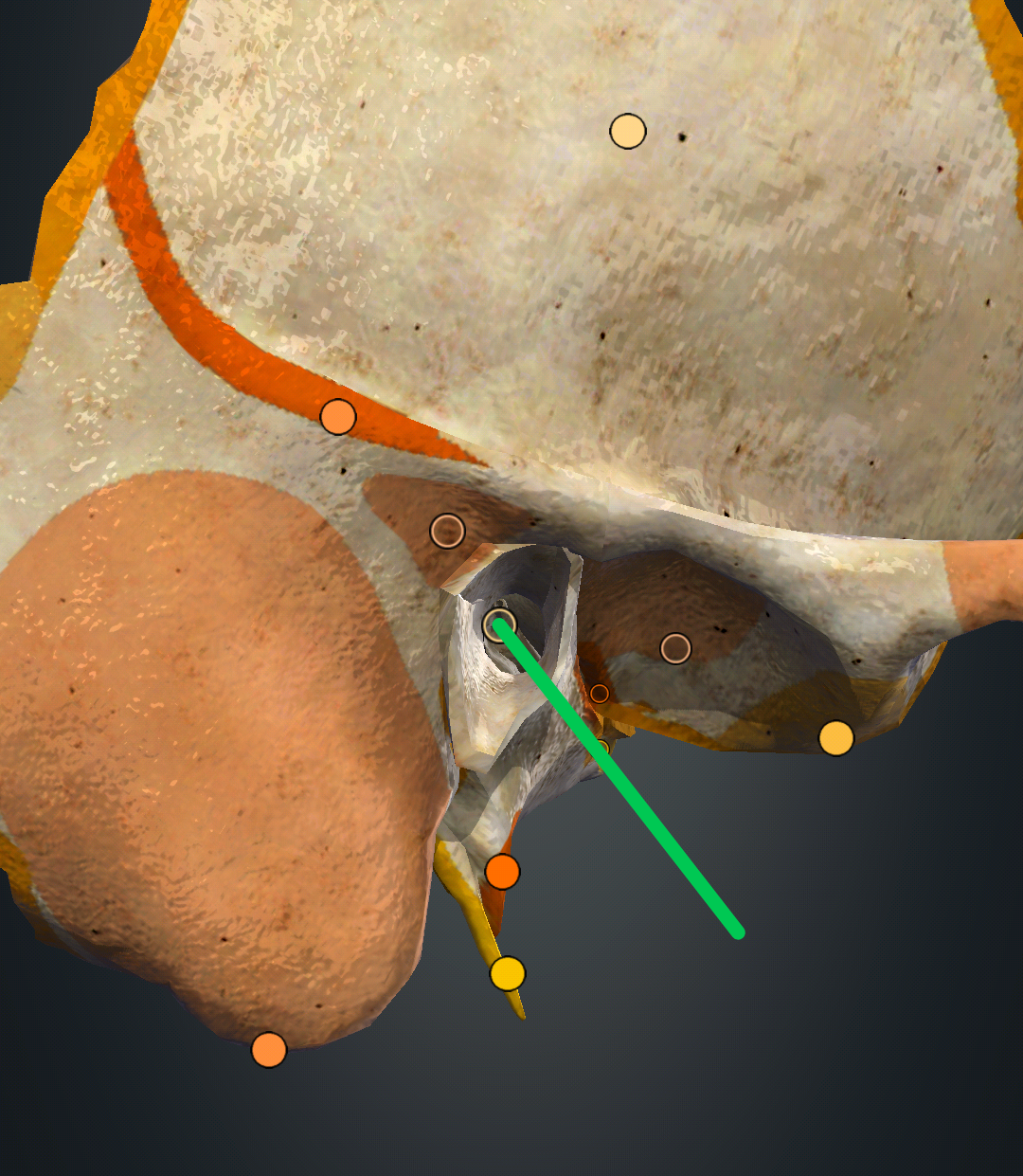 <p>meatus acusticus externus</p>