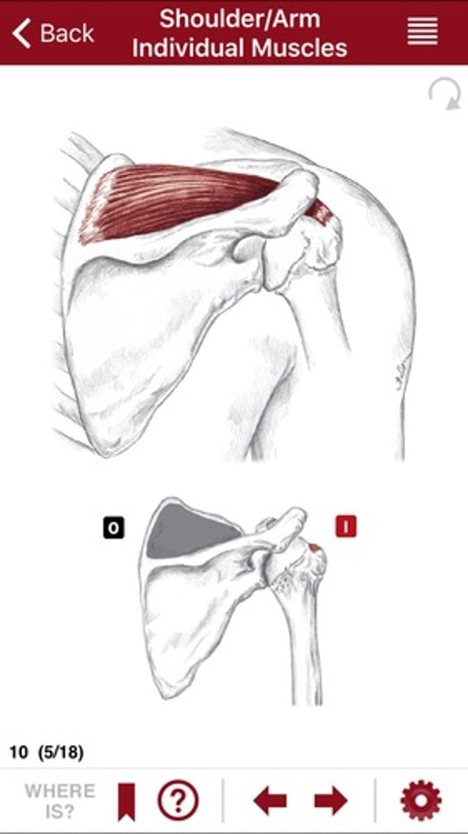<p>What is this and what does it do? Give an origin and insertion.</p>