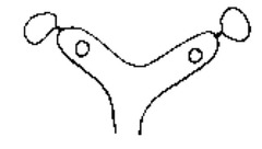 <p>Describe this fixation. What issues does it cause?</p>