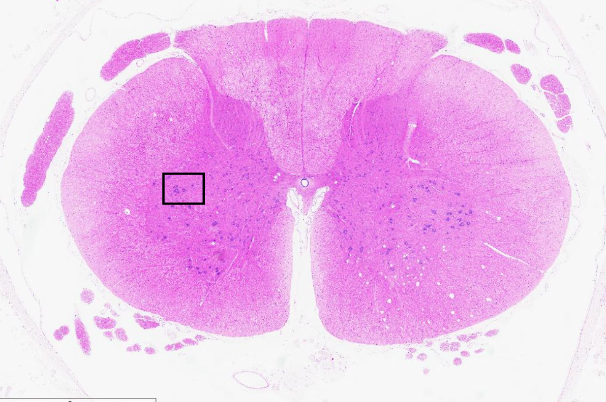 <p>Nervous tissue</p><p>Spinal cord neurons</p>