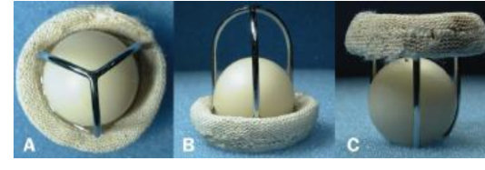 <p>• No longer implanted</p><p>• Due to durability may still be</p><p>encountered</p><p>• Sewing ring with metal struts</p><p>forming a cage</p><p>• Hollow ball in cage</p><p>• Appearance of echoes in the left</p><p>atrium due to speed of sound in</p><p>the ball</p><p>• Flow occurs around the ball</p><p>• Normal regurgitant volume 2-5mL</p>