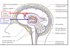 <p>2</p><p>Cavity located in the interior of each cerebral hemisphere; thus there</p><p>are 2 lateral ventricles.</p><p>The 2 lateral ventricles are the largest of the ventricles</p><p>both lateral ventricles are separated by septum pellucidum</p><p>Each communicates with the third ventricle by the interventricular</p><p>foramen of Monro</p>