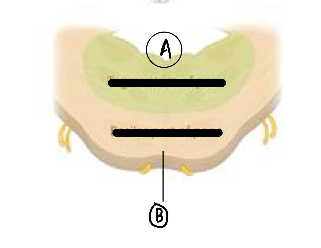 <p>What Pons structure does B represent? </p>