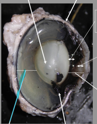 <p>What is the arrow pointing at?</p>