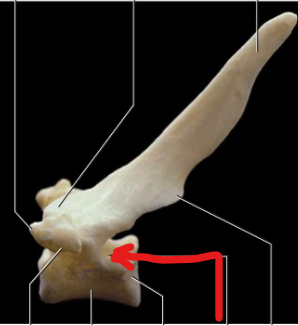 <p>Articular facets occurring on the centrum of adjacent thoracic vertebrae that articulate with the capitulum of a rib.</p>