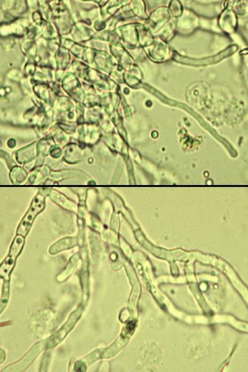 <ul><li><p>Filamentous and usually branching.</p></li><li><p>These kind of infections are rare, but considered quite serious when they do occur.</p></li></ul><p></p>