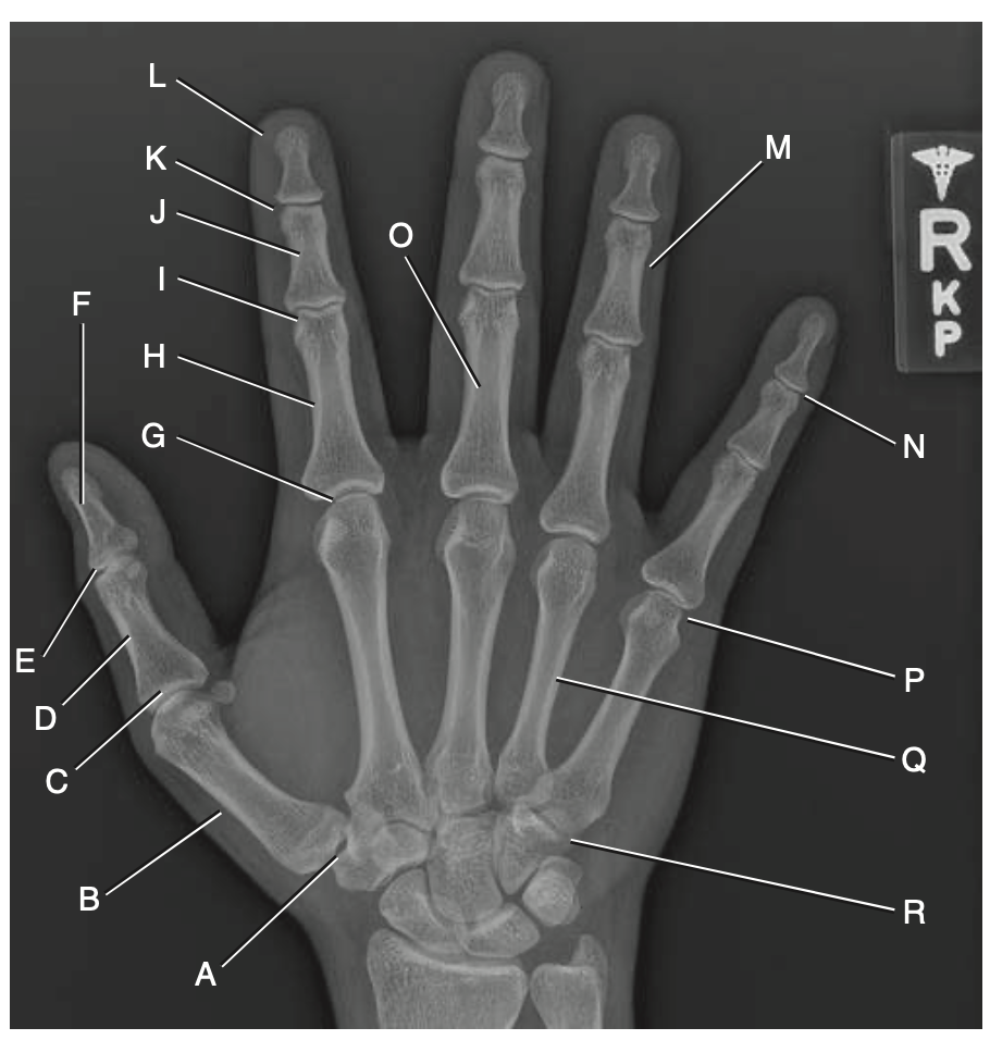<p>H</p>
