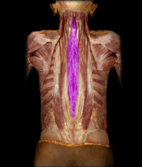 <p>composed of:</p><p>spinalis thoracis M</p><p>spinalis cervicis M</p><p>spinalis capitis M</p>