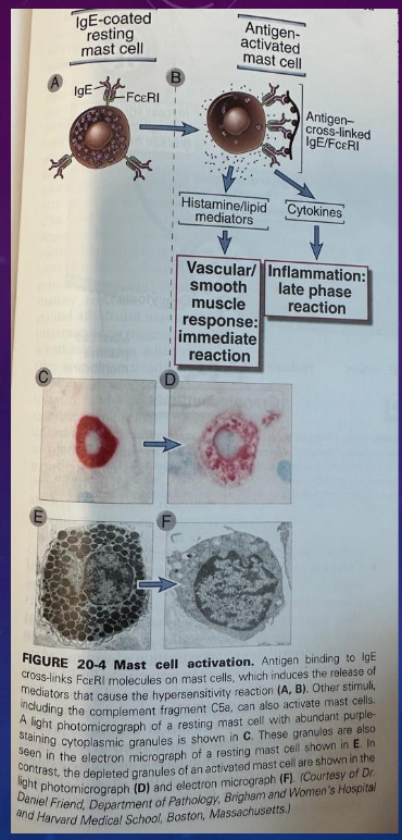 <p>illustrating mast cell activation and histamine release </p>