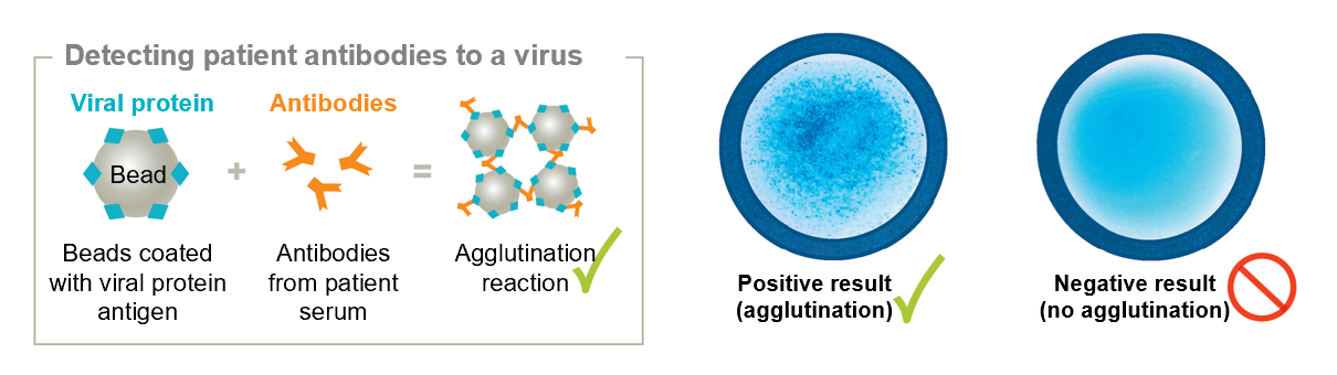 <ul><li><p><strong>Viral antigens/proteins</strong> are linked to tiny latex beads</p></li><li><p>Mixed with the sample that has antibodies</p></li><li><p>If the patient has antibodies that bind to the viral antigen, then the beads will agglutinate when exposed to the patient’s serum</p></li></ul><p></p>