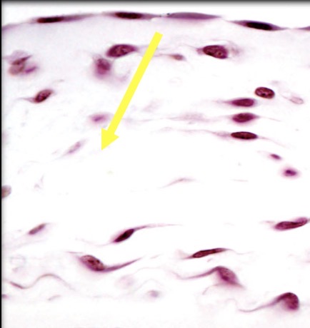 <p>What is the type tissue in this image?</p>