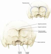<p>Nuchal ligament attachment</p><ul><li><p>Occipital</p></li></ul><p></p>