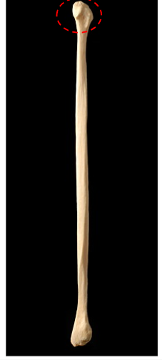 <p>Articulates with the lateral condyle of the tibia</p>