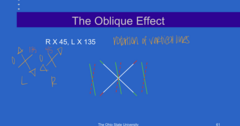 <p>What is the Oblique Effect on the Space Eikonometer when R x 045; L x 135?</p>